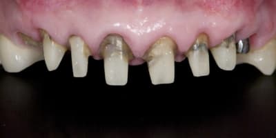 Dsc 4226 aufcs5 - Eugenol