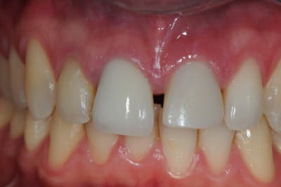 Dsc 4360 jdgw1p - Eugenol