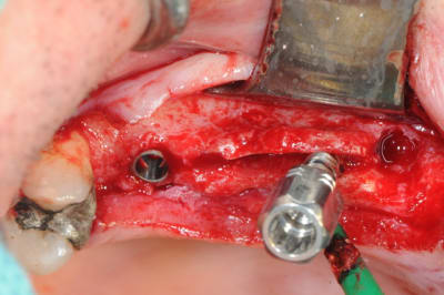 Dsc 4591 a1nen0 - Eugenol