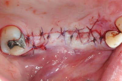 Dsc 4620 pwdce9 - Eugenol