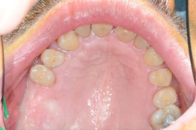 Dsc 4772 if8lmb - Eugenol