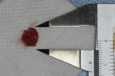 Dsc 4995 appzhr - Eugenol