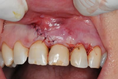 Dsc 5009 nj9wvi - Eugenol