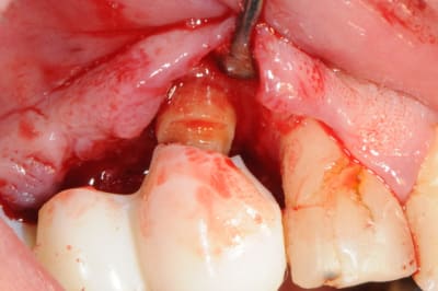 Dsc 5082 tzrtza - Eugenol