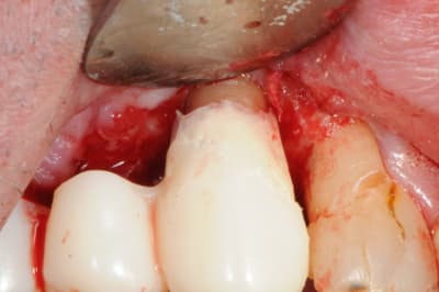 Dsc 5086 xtcgje - Eugenol