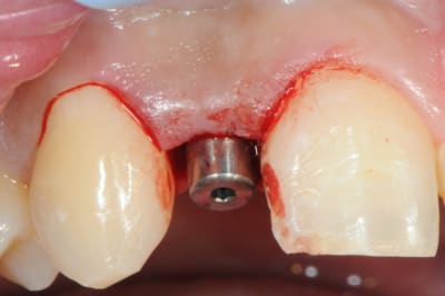 Dsc 5189 cmpveh - Eugenol