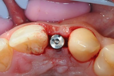 Dsc 5193 c5mpgs - Eugenol