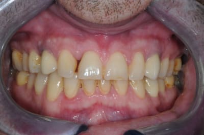 Dsc 5327 wbzmi9 - Eugenol