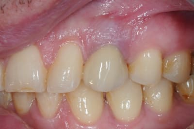 Dsc 5328 k2w7uj - Eugenol