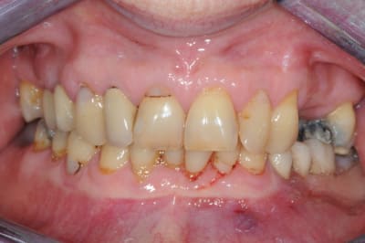 Dsc 5494 ptylvp - Eugenol