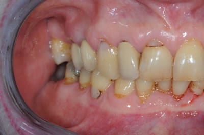 Dsc 5496 zl1hti - Eugenol