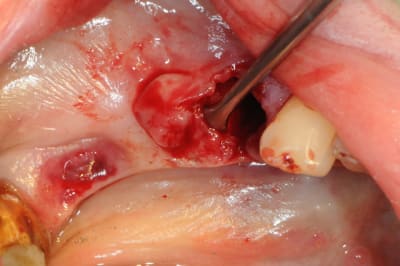 Dsc 5500 dspwi3 - Eugenol