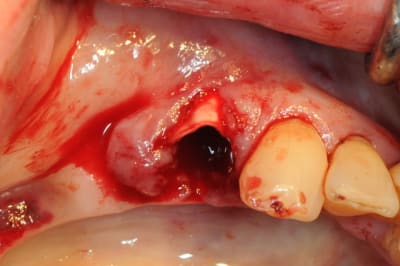 Dsc 5501 k46pxv - Eugenol