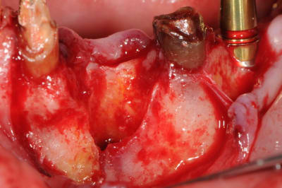 Dsc 5631 uvojsj - Eugenol