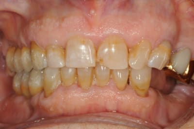 Dsc 5837 ch98nn - Eugenol