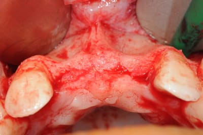 Dsc 5942 fiqvut - Eugenol