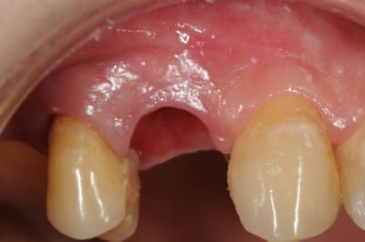 Dsc 5946 qgy5xn - Eugenol