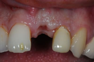 Dsc 5973 dfdcjj - Eugenol