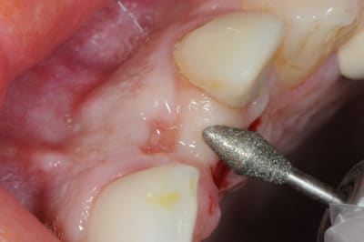 Dsc 5974 xlrkec - Eugenol