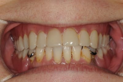 Dsc 6073 pcexrz - Eugenol