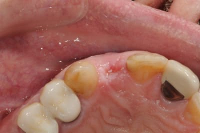 Dsc 6097 ehhnpo - Eugenol