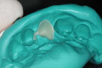 Dsc 6216 os12mw - Eugenol