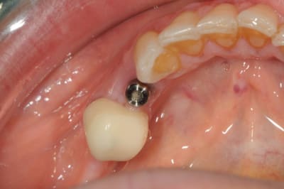 Dsc 6230 klym0j - Eugenol