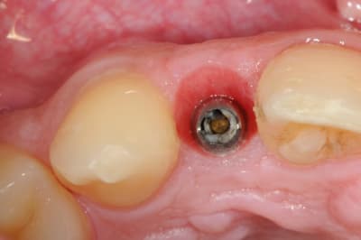 Dsc 6256 nxo42x - Eugenol