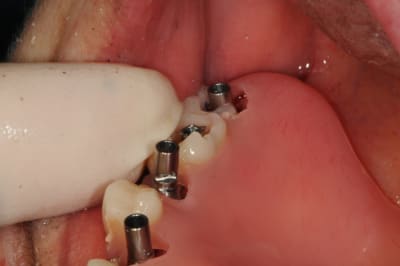 Dsc 6341 sa986y - Eugenol