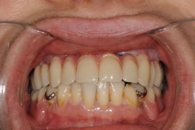 Dsc 6379 zhu8j3 - Eugenol
