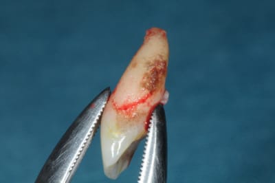 Dsc 6468 tkckkp - Eugenol