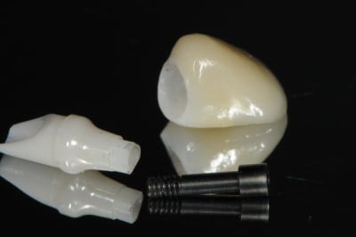 Dsc 6475 ll6uvt - Eugenol