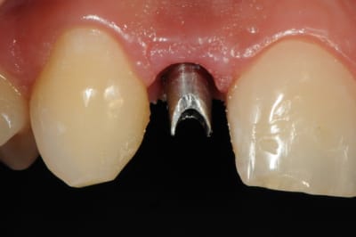 Dsc 6480 p0tdiy - Eugenol