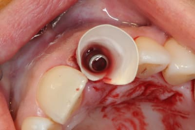 Dsc 6487 kfbz4g - Eugenol