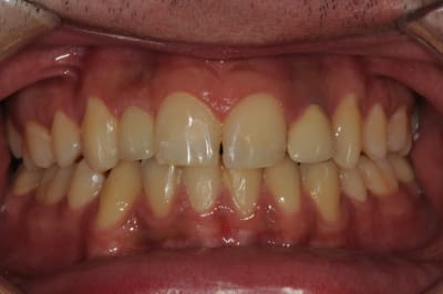 Dsc 6570 iriusn - Eugenol