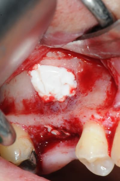 Dsc 7202 eys5w1 - Eugenol