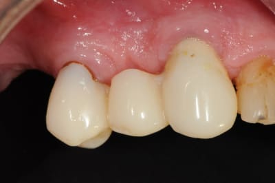 Dsc 7606 ghqwf2 - Eugenol