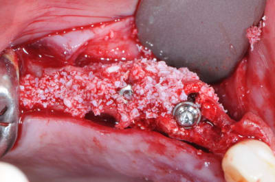 Dsc 7724 nd883w - Eugenol