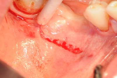 Dsc 7789 y84vqo - Eugenol