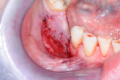 Dsc 7802 v7cini - Eugenol