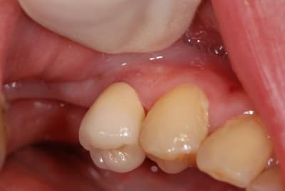 Dsc 7894s fcuwoy - Eugenol
