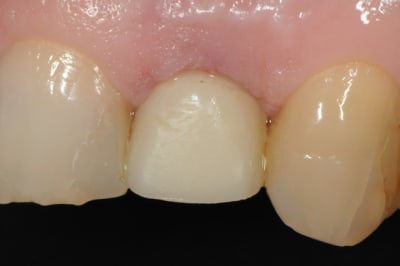 Dsc 8007 jytddc - Eugenol