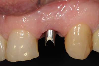 Dsc 8009 q4spsu - Eugenol