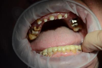 Dsc 8838 v6zsvv - Eugenol