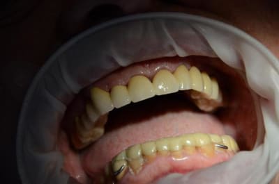 Dsc 8844 nkzjlb - Eugenol