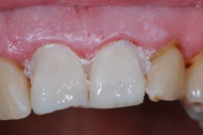 Dsc 9041 tscrrf - Eugenol