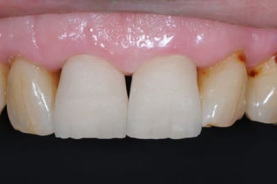 Dsc 9062 jowx9t - Eugenol