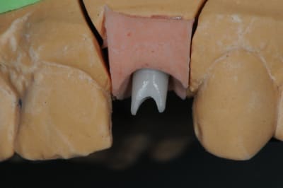 Dsc 9295 fwp1lp - Eugenol