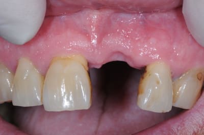 Dsc 9326 jbnd5b - Eugenol