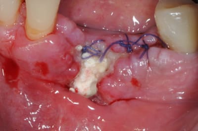 Dsc 9884 kaalti - Eugenol